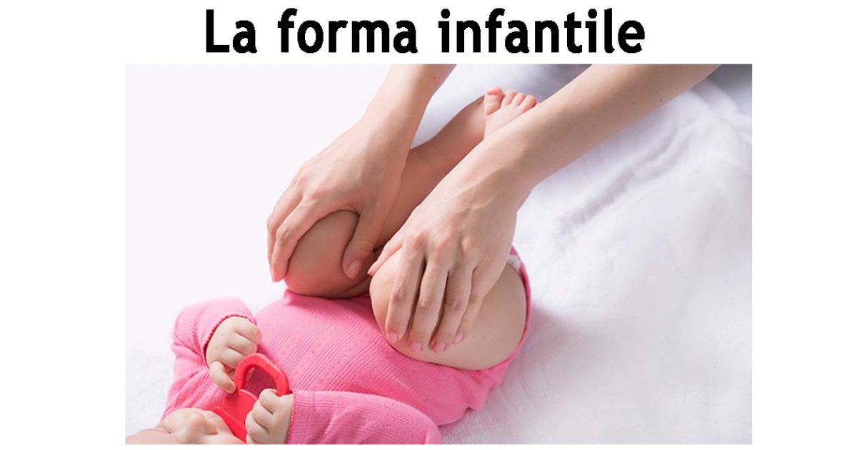 2015-laformainfantile-evidenza
